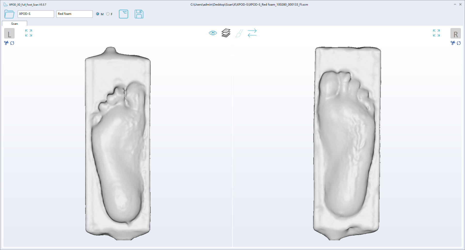 ScanPod3D 3D Laser Foot Scanner | Orthotic Insole CAD & CAM ...