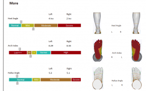 3D foot scanner 三维足部扫描仪