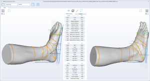 3D foot scanner 三维足部扫描仪